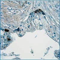 Angiopoietin-1 in immersion fixed paraffin-embedded sections of human prostate cancer tissue