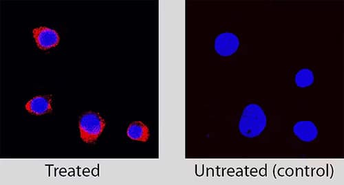 Caspase-3 in Jurkat human actute T cell leukemia cell line treated with Staurosporine or untreated controls detected by immunocytochemistry with staining only in the treated cells