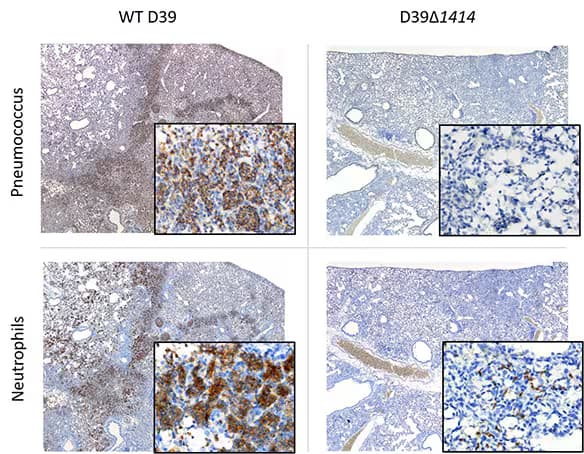 Immunohistochemistry (IHC) of Streptococcus pneumoniae (pneumococcus) and influenza A-infected lung sections.