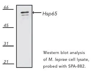 Western blot analysis of 65 kDa heat shock protein in Mycobacterium leprae’s cell lysate.