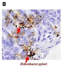 Quorum sensing inhibitors from Tocris allow modulation of bacterial communication by inhibiting the expression of virulence factors.