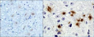 Image showing beta amyloid antibody staining in normal mouse brain and Alzheimer's disease model