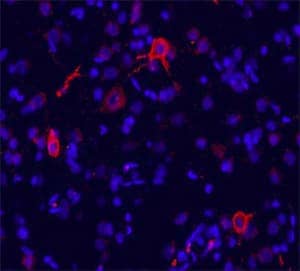 Novus Biologicals antibody for mGluR1 was used to detect the GPCR in the cingulate cortex of rat brain.