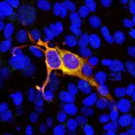 CRISPR-Cas9 in HEK293 cells transfected with construct containing S. pyogenes CRISR-Cas9 fused to GFP detected by immunocytochemistry showing transfected cells (green) that bind the antibody (red) produce a yellow signal.