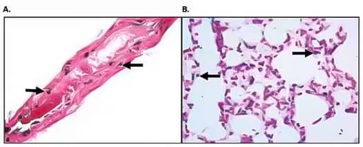 DNA fragmentation in tissue section