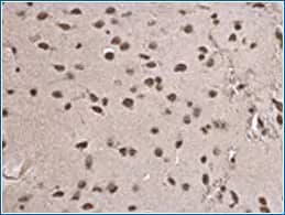 H3.3 Variant Brain Expression, IHC