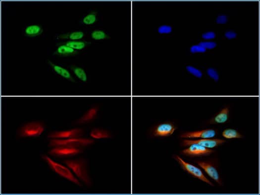 DNMT1 protein expression in HeLa cells, ICC