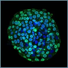 Immunocytochemistry/Immunofluorescence: CENPA Antibody (5A7-2E11)