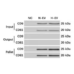 Western blot showing detection of exosome markers CD9 and CD81 in exosome pellet, not in supernatant after ultracentrifugation.