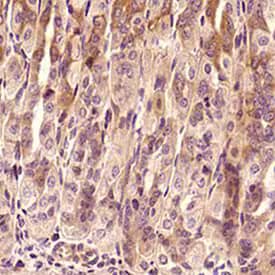 Immunohistochemical expression of rabbit polyclonal anti-TNF-alpha antibody in formalin fixed paraffin-embedded mouse intestine, stained with HRP-DAB kit, and counterstained with hematoxylin.