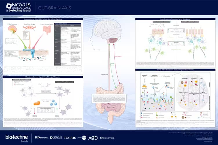 Novus’ educational poster illuminating the Gut-Brain Axis connection. 