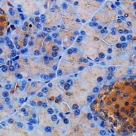 Immunohistochemical staining of mouse pancreas with rabbit polyclonal anti-Somatostatin Receptor 2/SSRT2 and counterstained with DAB and hematoxylin.