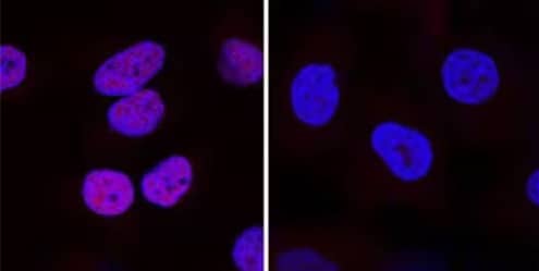 HIF-1alpha detection in HeLa cells