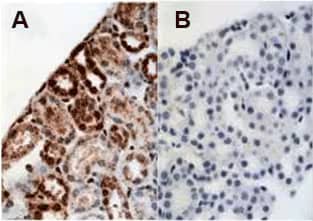 IHC-P analysis of mouse kidney showing (A) staining with HIF-1 Alpha antibody NB100-479 and (B) NBC1-18422 as blocking control for NB100-479