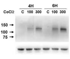 HIF-1 alpha antibody NB100-105