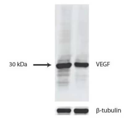 WB analysis of lysates from HUVEC and 293T cells using VEGF antibody NB100-664