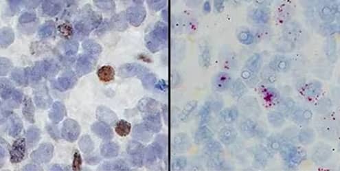 Dual RNAscope ISH/IHC detection of CD11b expression in FFPE tissue sections of human lymph node 