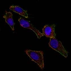 Confocal immunofluorescent analysis of ovarian cancer cell line SK-OV-3