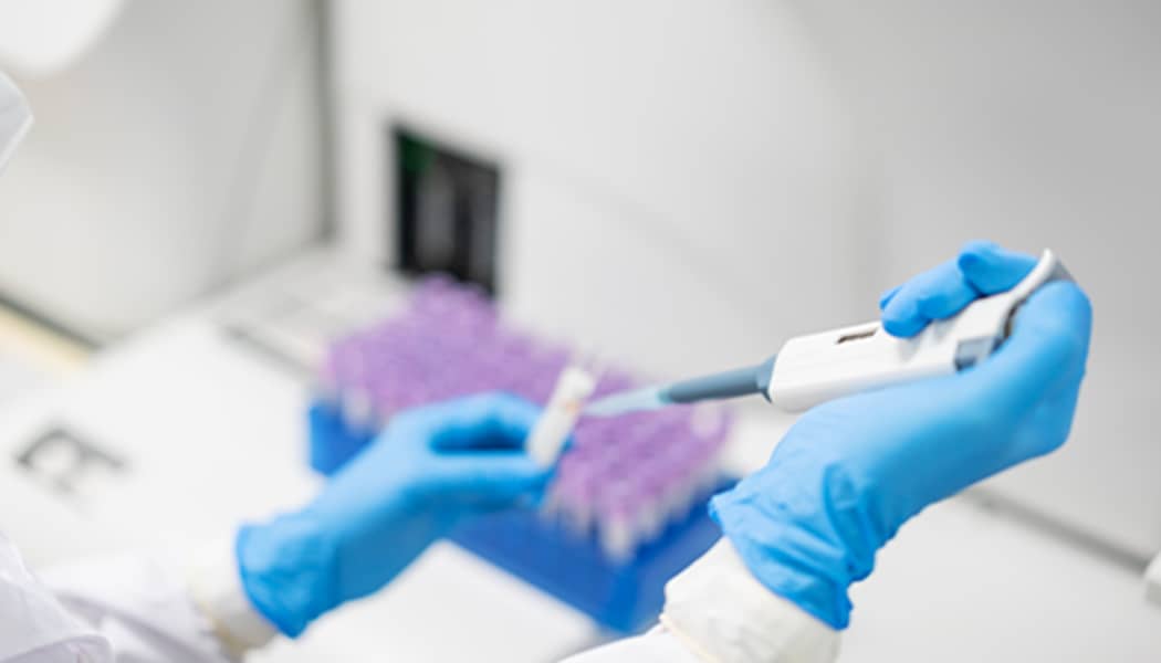 BDD Immunoassay Development Card