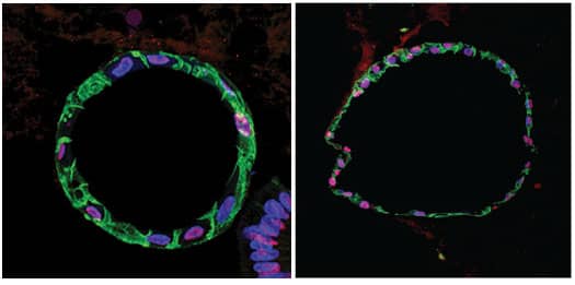 Staining of undifferentiated human gastric organoids with antibodies against E-Cadherin and HOXB7 with DAPI nuclear staining.