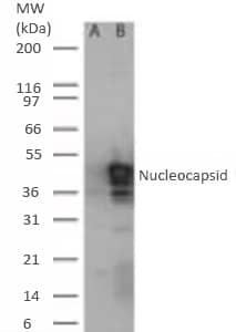 SARS nucleocapsid protein antibody Western blot image