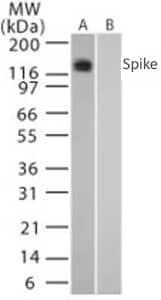 SARS spike protein antibody western blot image 