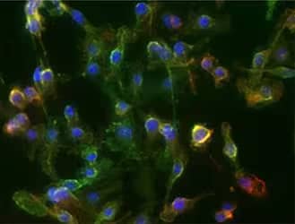 CD11b expression in mouse spleen IHC