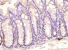 TLR3 expression in mouse colon IHC