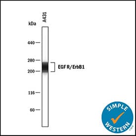 Identification of EGFR in lysates of A431 human epithelial carcinoma cell line by Simple Western