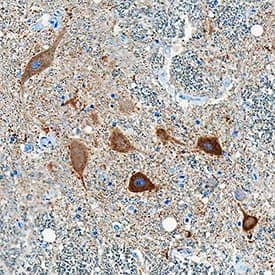 Immunohistochemistry image showing ret staining in human spinal cord