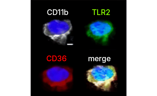 Confocal images of macrophages 