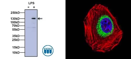 Images showing western blot data and immunocytochemistry in macrophages