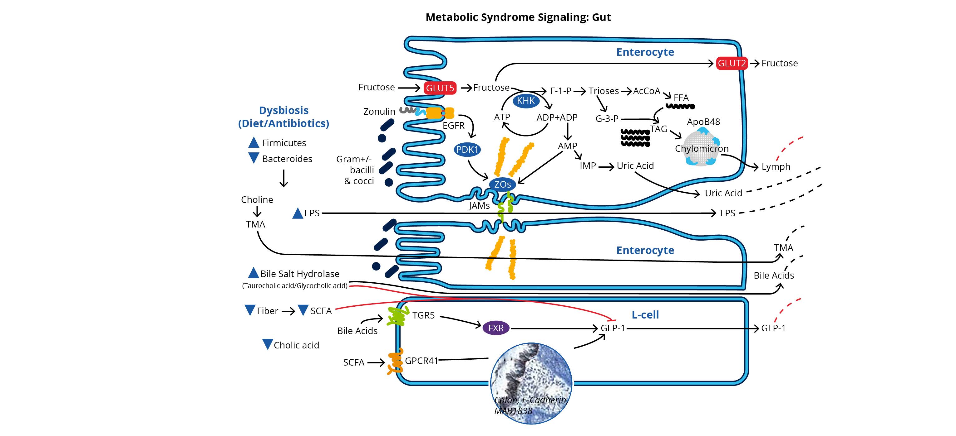 A poor diet and/or antibiotic use leads to dysbiosis and results in abnormal metabolite levels, increased LPS, reduced tight junction integrity and short chain fatty acids, interference with glucose homeostasis and causes inflammation.