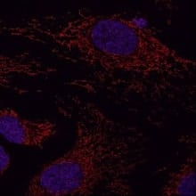 microscopy analysis of outer mitochondrial membrane protein Tomm20 in HeLa cells