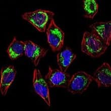 HeLa cells expressing Flag-tagged SpyCas9 using CRISPR-Cas9 antibody