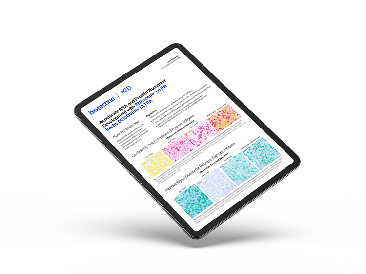 RNAscope on Roche Discovery Ultra Flyer Thumbnail