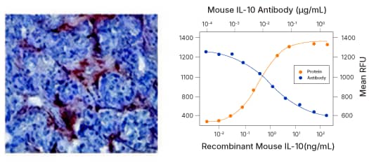 MMP-9 detection in human prostate cancer by IHC and blocking/neutralization 