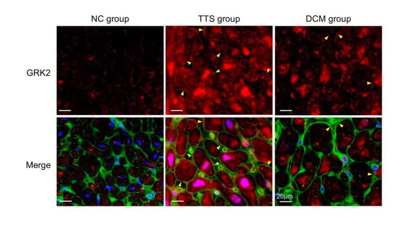 Novus Biologicals antibody for GRK2 was used to detect the GPCR in myocardial tissue.