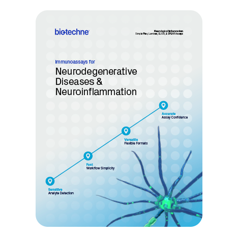 Immunoassays for Neuroinflammation product guide thumbnail