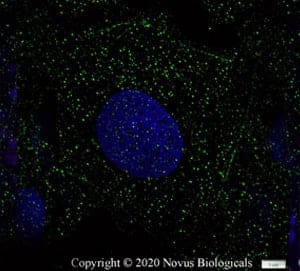 Novus Biologicals antibody for GPR18 was used to detect the GPCR in Ntera2 cells.