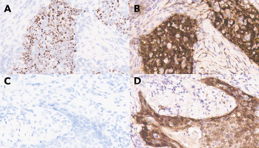 ACD RNAscope HPV High-Risk Probe - composite