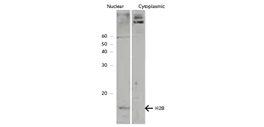 Histone H2b member S antibody