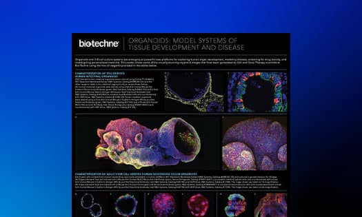 Image of the organoids wall poster