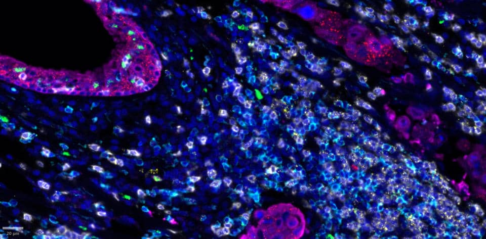 ACD ProximityScope image Her2-EGFR-blue