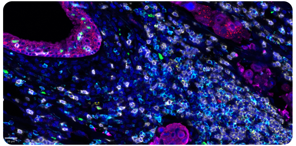 ProximityScope her2-egfr-blue