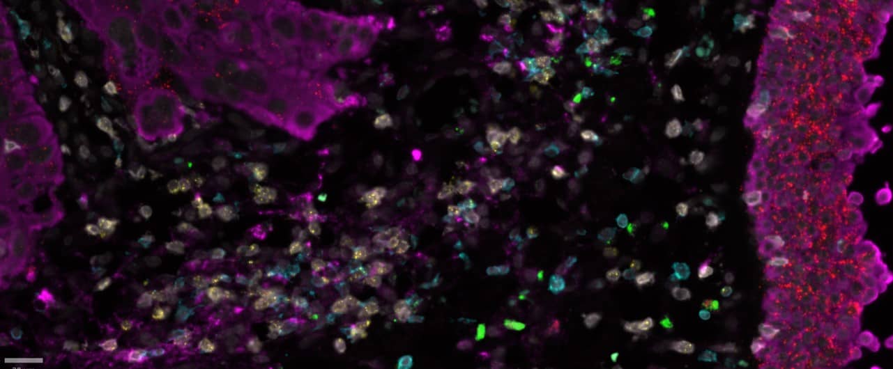 ACD ProximityScope image HER2-EGFR proximity