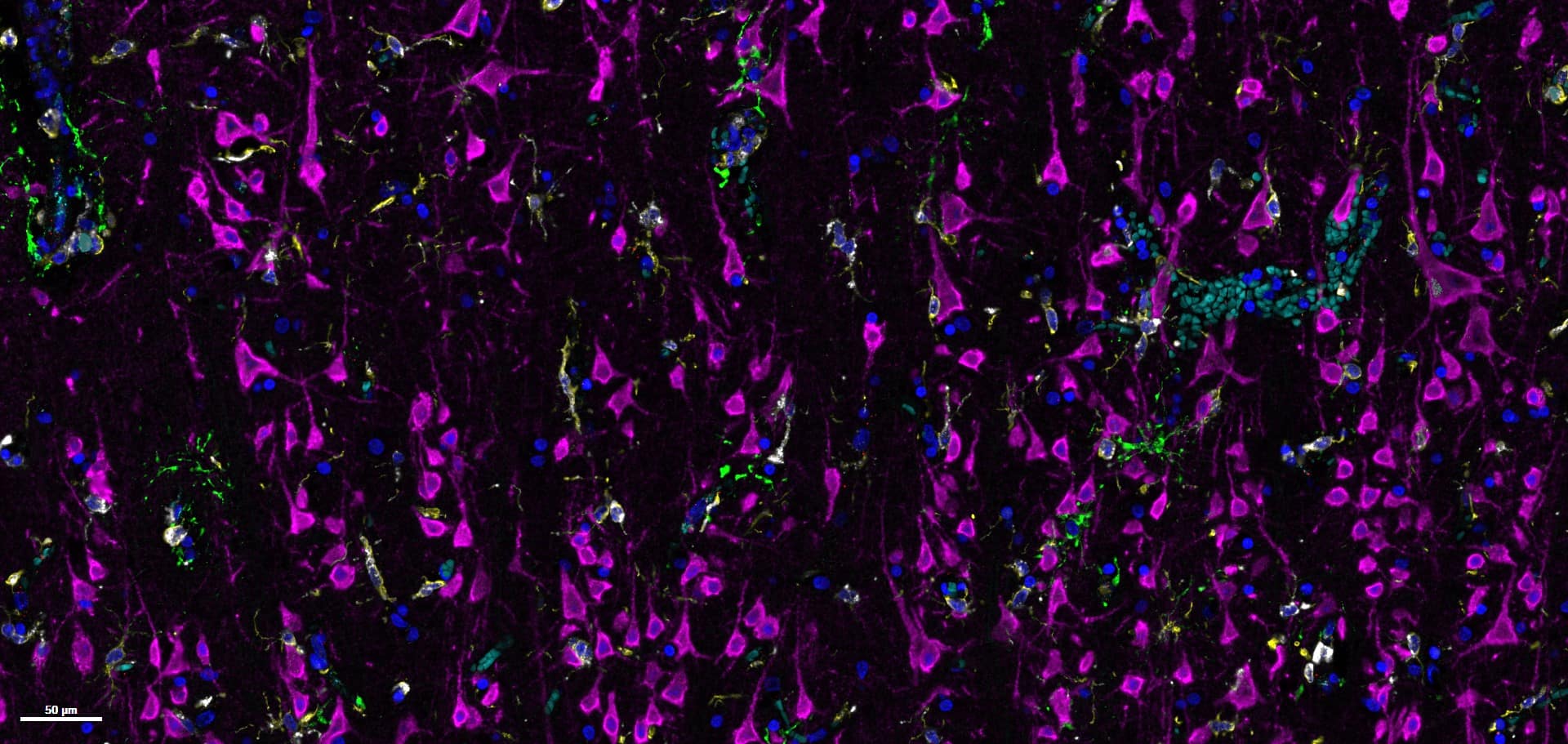 RNA –protein Multiomic assay 