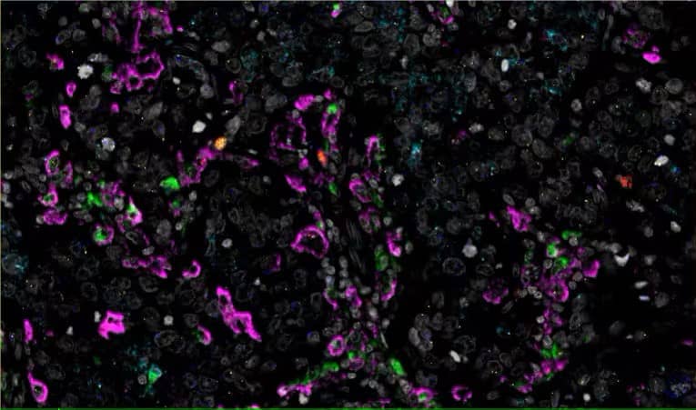 RNAscope fluorescent assay image 1a