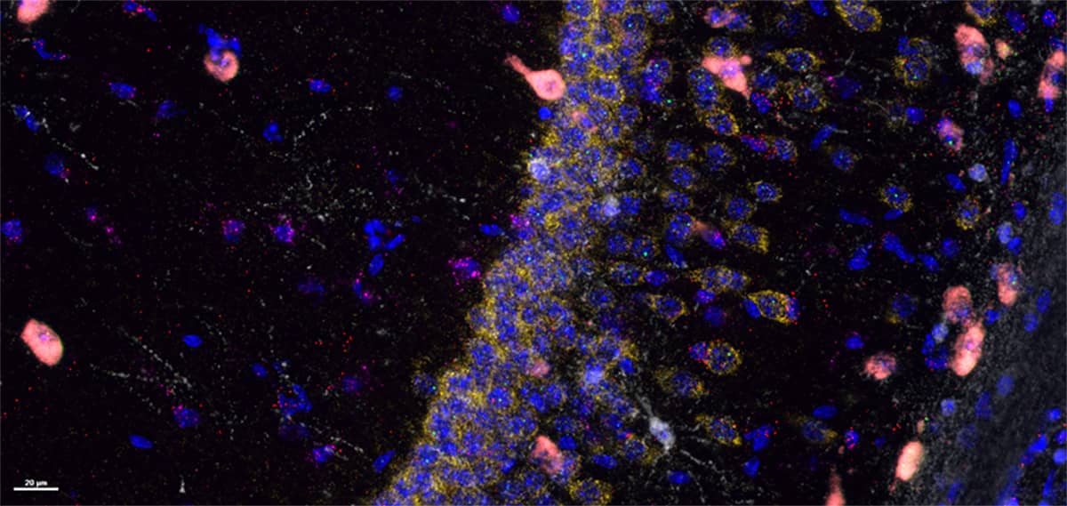 RNAscope fluorescent assay in mouse brain