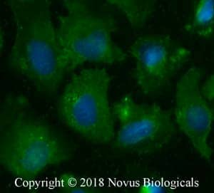 Novus Biologicals antibody for Somatostatin R2/SSSTR2 was used to detect the GPCR in U2OS cells.